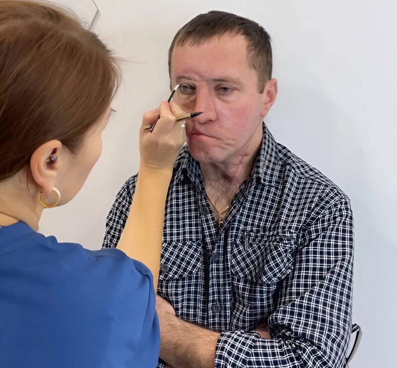 Diese Künstlerin tätowiert ein permanentes Auge auf das Gesicht eines Mannes, der nach einem tragischen Unfall entstellt wurde.