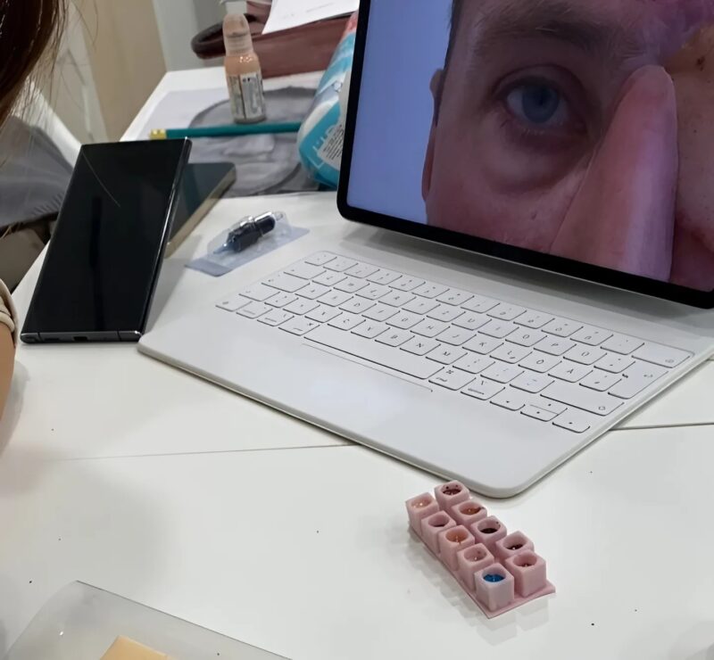 Diese Künstlerin tätowiert ein permanentes Auge auf das Gesicht eines Mannes, der nach einem tragischen Unfall entstellt wurde.
