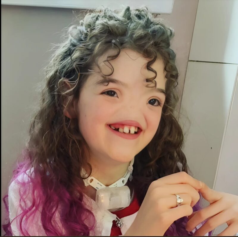 "Tessa: Das Mädchen, das ohne Nase geboren wurde und ihren Unterschied in eine inspirierende Stärke und ein Beispiel für Resilienz verwandelte"