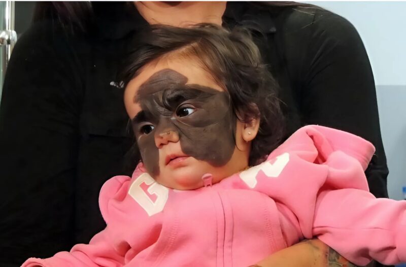 „Die Maske existiert nicht mehr: Die kleine Emma wurde dank einer innovativen Methode, die ihr Leben veränderte, auf wundersame Weise geheilt