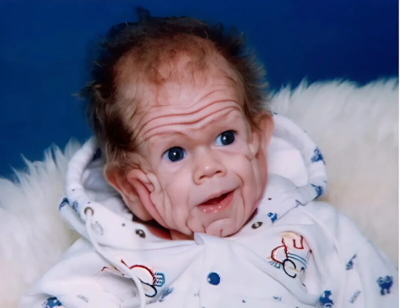 „Ein Baby mit einer seltenen Hautkrankheit gibt Ärzten von Geburt an Rätsel auf“