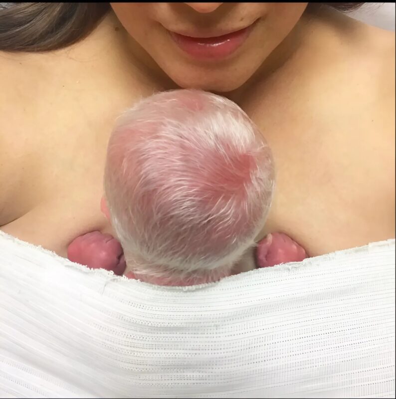 Liam, der Junge, der mit grauen Haaren geboren wurde und zu einem Symbol für einzigartige Schönheit und Akzeptanz wurde ✨