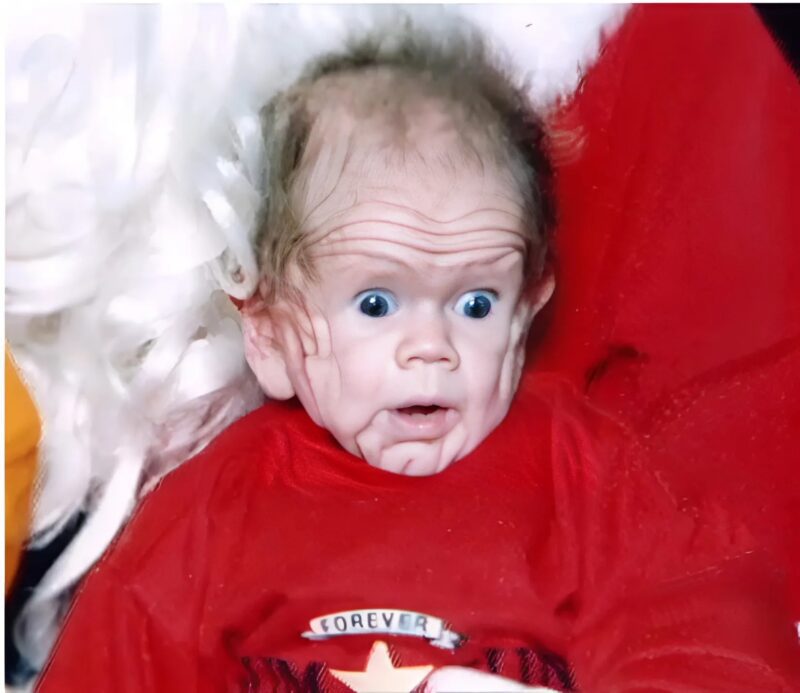 „Ein Baby mit einer seltenen Hautkrankheit gibt Ärzten von Geburt an Rätsel auf“