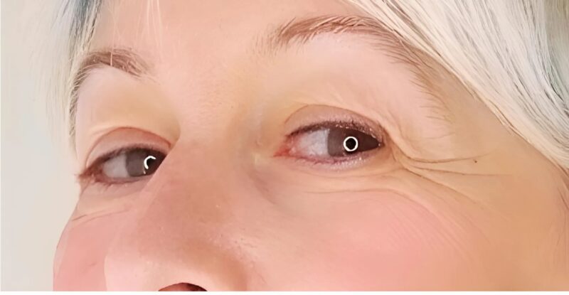 Drei ganz einfache Tipps, um Ihren Blick nach 55 Jahren strahlen zu lassen