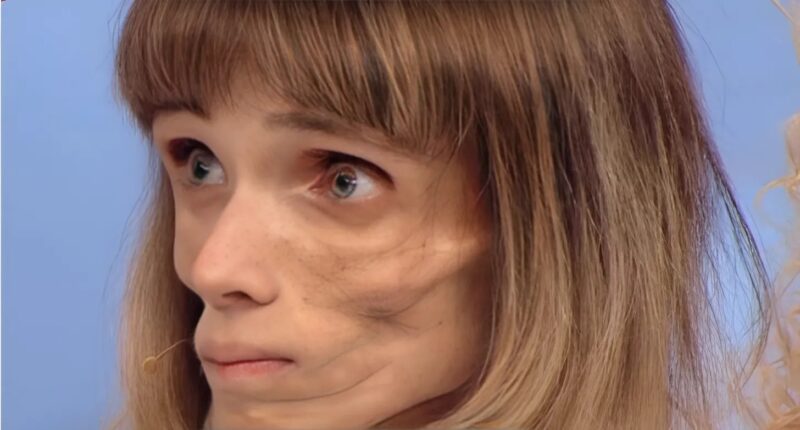 Mit 22 Jahren stürzte dieses Mädchen auf 17 Kilo ab – bevor sie die Kraft fand, neu zu beginnen